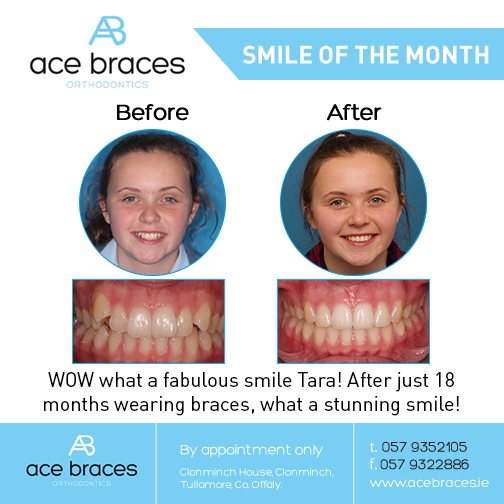 braces in ireland best orthodontist